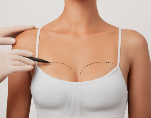 Breast augmentation post operative consultation and follow up care