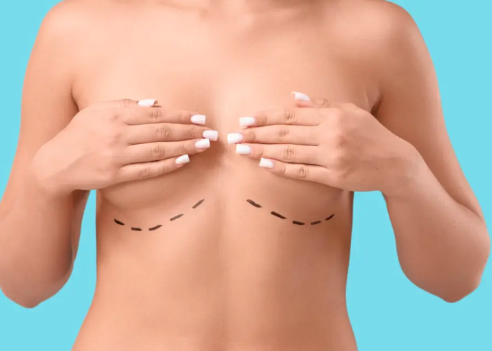Breast augmentation consultation with patient and surgeon