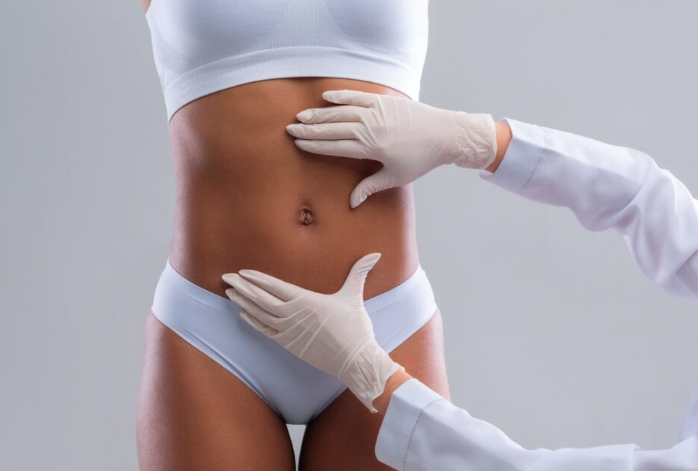 Belt lipectomy consultation and lower body contour planning