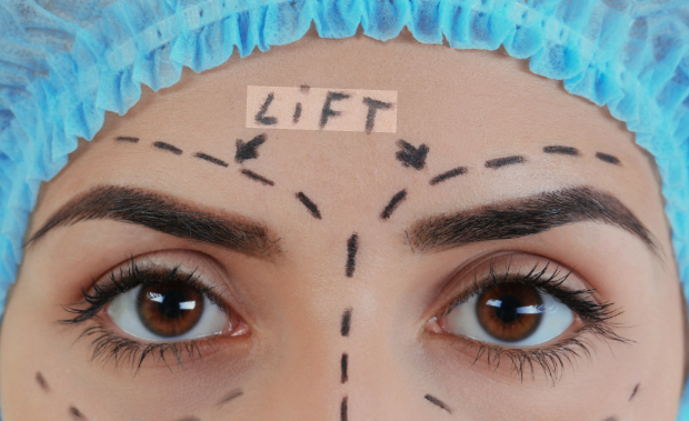 Eyebrow lift consultation and brow evaluation